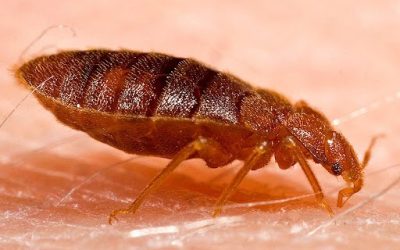 How to Treat Bed Bug Bites on Human Skin: Relief, Remedies & When to Act