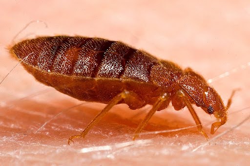 How to Treat Bed Bug Bites on Human Skin: Relief, Remedies & When to Act